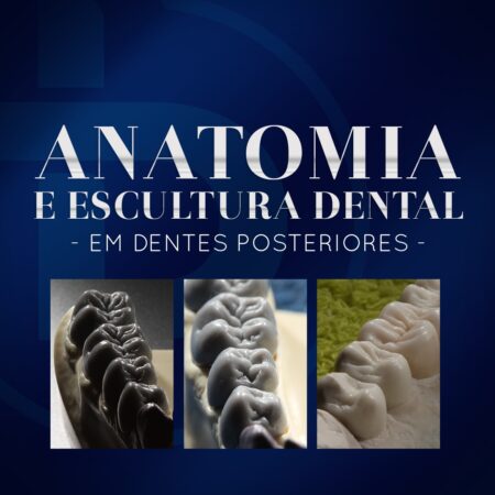 ANATOMIA E ESCULTURA DENTAL- EM DENTES POSTERIORES